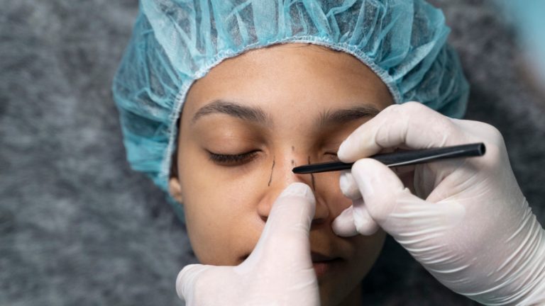 Les étapes de la rhinoplastie : de la consultation à la convalescence