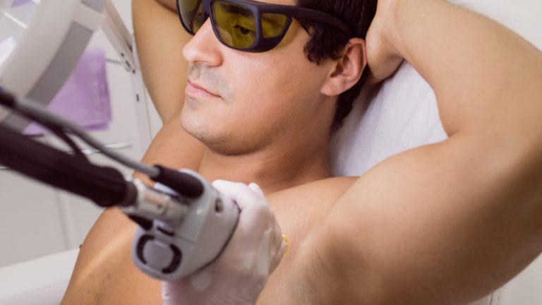 Centre d’épilation laser homme à Toulouse : comment bien choisir ?